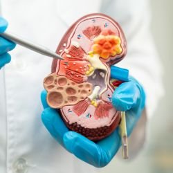 Tratamento da Doença Renal Crônica em Curitiba