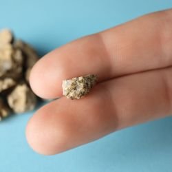 Tratamento o Cálculo Renal em Curitiba